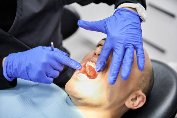 Best Dentist for Tooth Abscess  in Inverness, CA